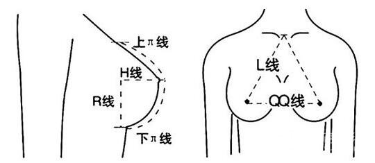 乳房假体植入手术的过程及原理剖析