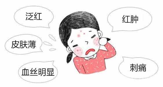 激光去红血丝靠谱吗 价格是多少？