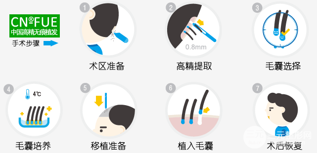 天津三甲医院可以植发吗 天津三甲医院可以植发吗