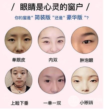 做埋线双眼皮多少钱?