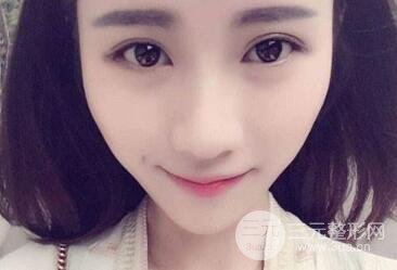 埋线双眼皮手术的注意事项