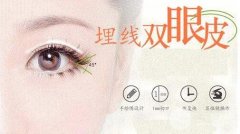 埋线双眼皮有哪些优缺点?适合人群有哪些?
