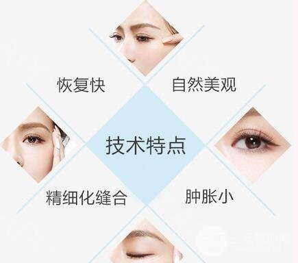 埋线双眼皮的价格