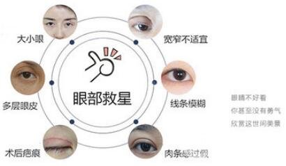 切开双眼皮手术优点 适合哪些人