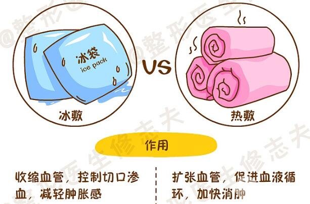 切开双眼皮多久消肿 术后注意事项