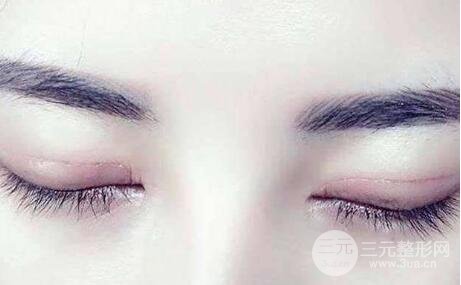 埋线双眼皮好吗?眼皮会留疤吗?