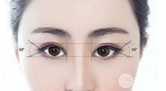 埋线双眼皮多久完全恢复定型？完全看不出？