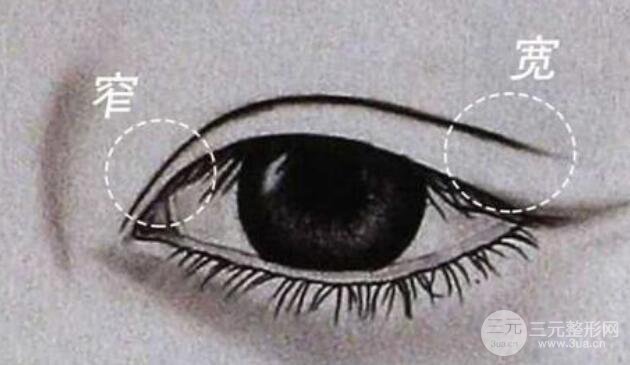 影响埋线恢复的因素