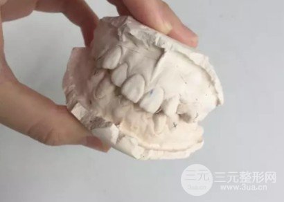 北大口腔正畸案例