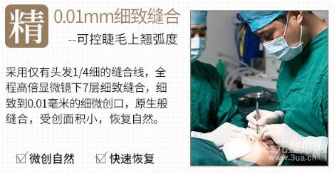 八大处宗宪磊做双眼皮怎么样 多少钱