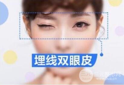 割双眼皮的优点