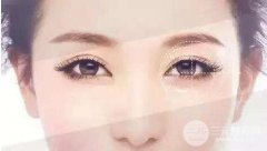 定点双眼皮和埋线双眼皮的区别有什么？