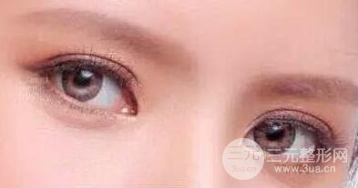 单眼皮割双眼皮好还是埋线好？哪个好一点？