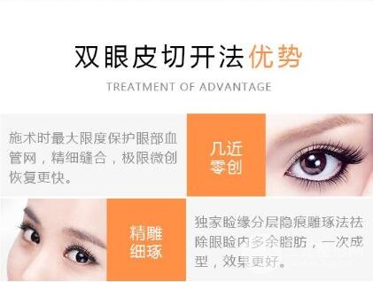 什么是切开双眼皮?
