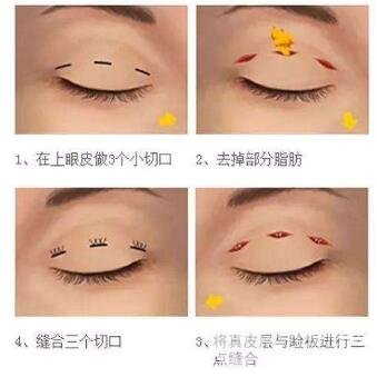 影响和价格的原因有哪些？