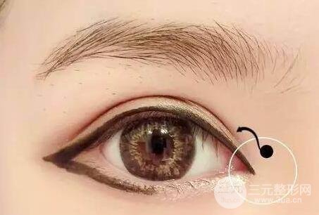 开眼角的风险