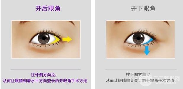 开眼角有什么危害？