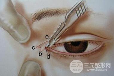 开眼角有什么危害？