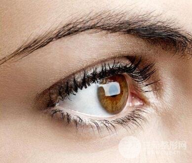 开眼角的术后注意事项