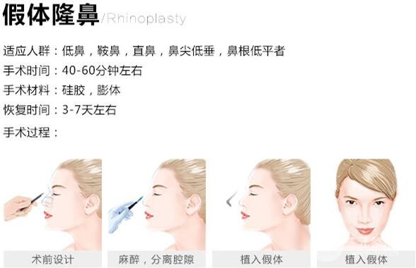 假体隆鼻手术简介