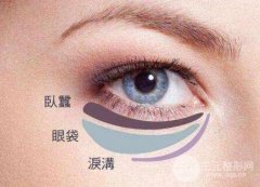 去眼袋手术有什么风险？风险大吗？