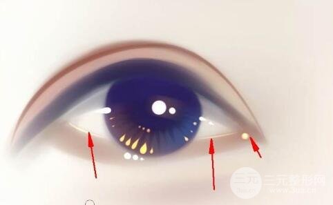 去眼袋手术后要注意些什么?