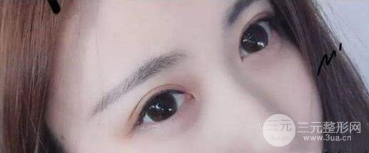 术后注意事项