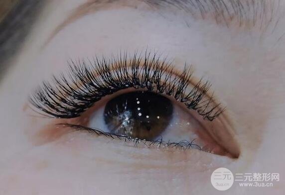 双眼皮修复手术应该几天之后进行还是几个月之后？