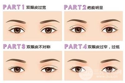 双眼皮手术失败的原因