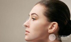 鼻翼缺损修复的**高吗？难度大吗？