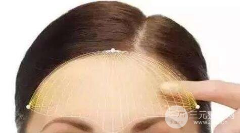 隆额头手术方式