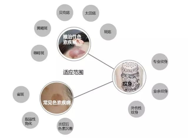 武汉一医院激光价目表|光子嫩肤祛斑案例反馈附上！