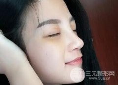 韩国假体隆鼻技术怎么样?哪家医院口碑好? 韩国假体隆鼻技术怎么样?哪家医院口碑好?