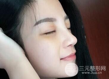 韩国假体隆鼻技术怎么样？哪家医院口碑好？