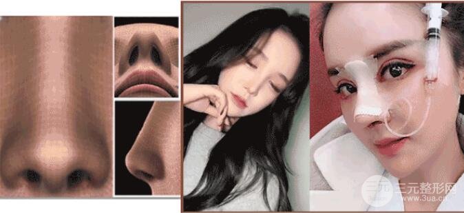 韩国普罗菲耳profile整形医院