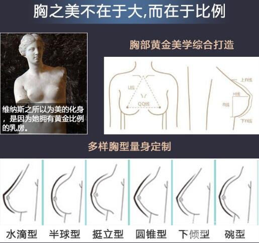 娜绮丽假体型号及价格如何选择