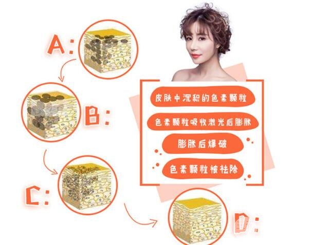 黑脸娃娃价格与自身皮肤有关