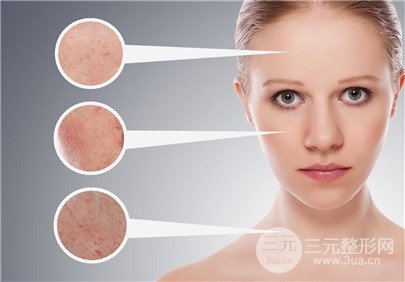 e光美容的功和作用 修复多种肌肤问题~