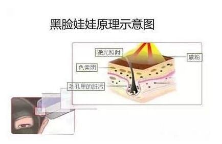 黑脸娃娃原理