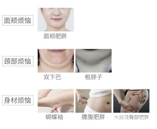 注射溶脂适合部位