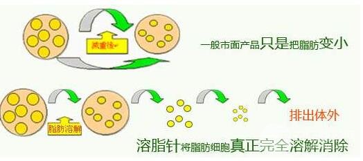 注射溶脂减肥瘦身的原理