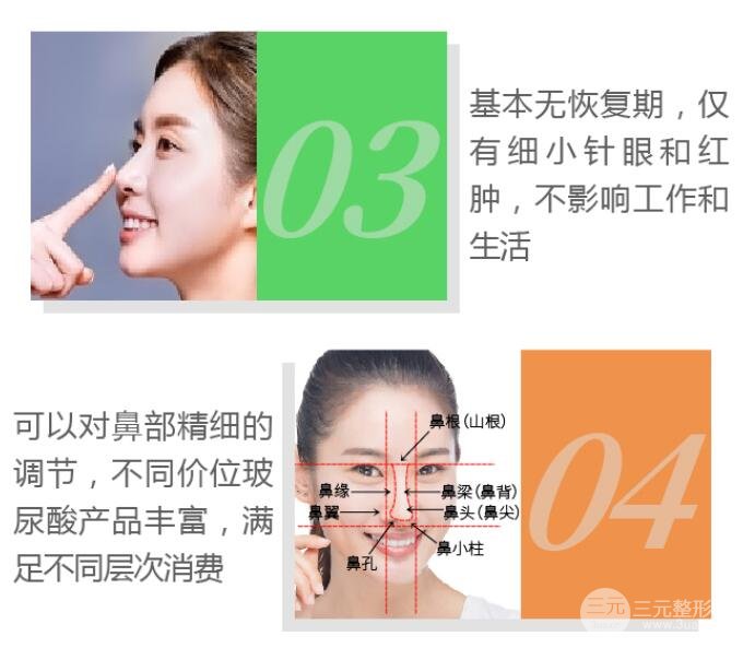 注射隆鼻特点