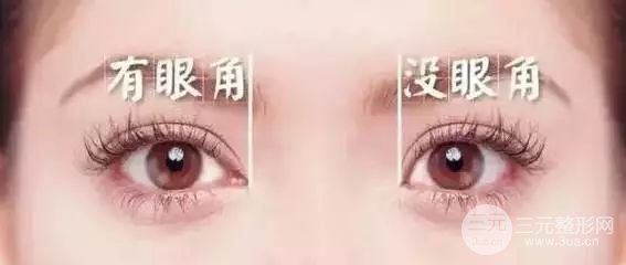 开眼角价格贵不贵，要看方式对不对！