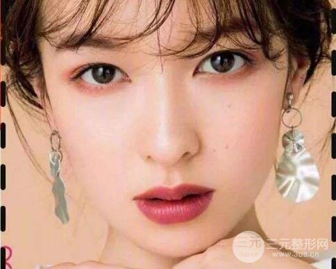 内切祛眼袋后遗症有哪些?几天消肿?