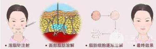 注射溶脂的果