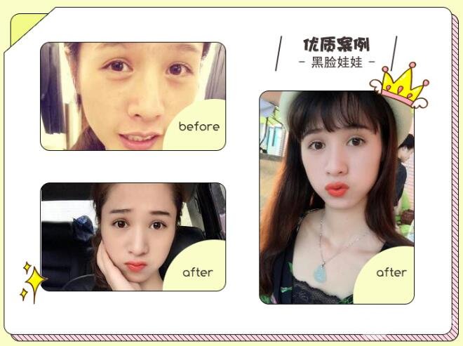 黑脸娃娃操作前