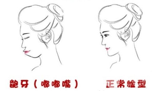 上海九院牙齿整形价格表