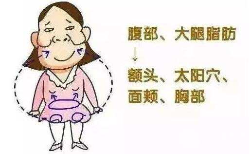 面部脂肪填充的原理图
