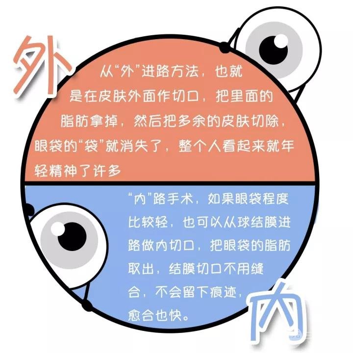 去眼袋手术