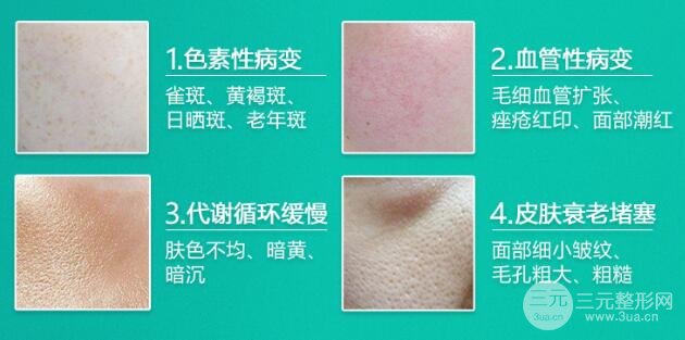 飞顿光子嫩肤果